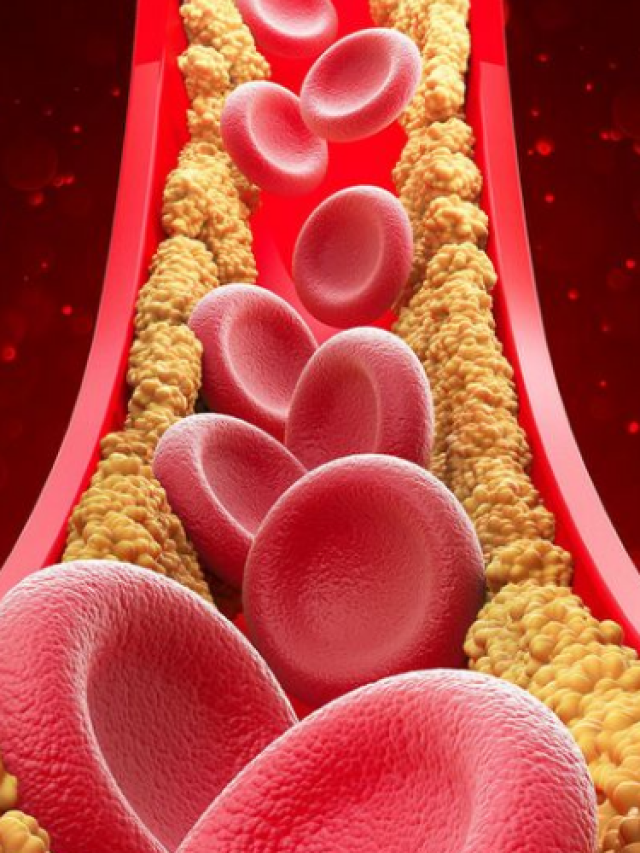 Natural Cholesterol Management