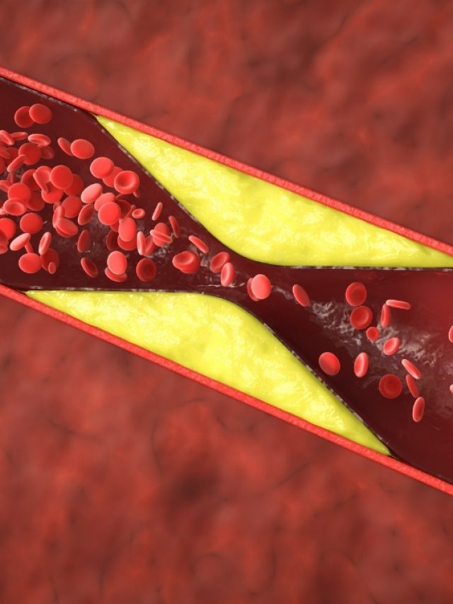Cholesterol Balance